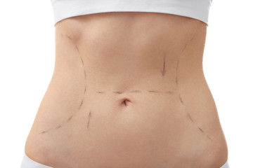 Fototapeta na wymiar Female tummy on white background. Plastic surgery concept