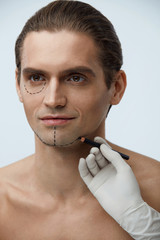 Facial Beauty Operation. Handsome Man With Lines On Face