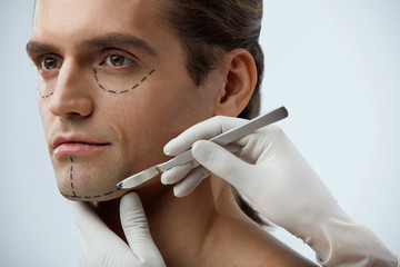 Handsome Man With Lines On Face Before Plastic Surgery