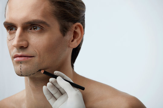 Facial Beauty Operation. Handsome Man With Lines On Face