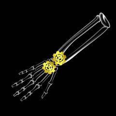 Arm bone and finger bone,pain,x ray