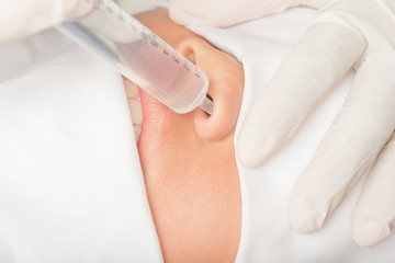 The nasal wash In patients with sinus