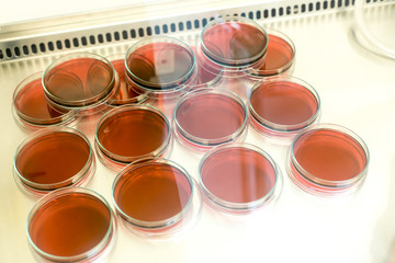 Eosin Methylene Blue (EMB) Agar for culture medium for Inoculum tests in Biological safety cabinets lab.