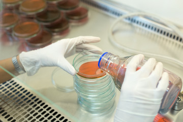 Eosin Methylene Blue (EMB) Agar for culture medium for Inoculum tests in Biological safety cabinets...