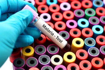 Blood sample for malaria test - obrazy, fototapety, plakaty