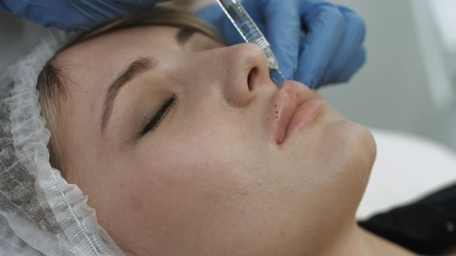 Injections of hyaluronic acid in the lips in the beauty salon
