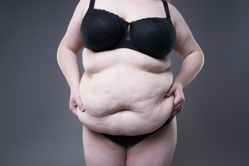 Fat female belly, overweight body, woman with stretch marks on abdomen