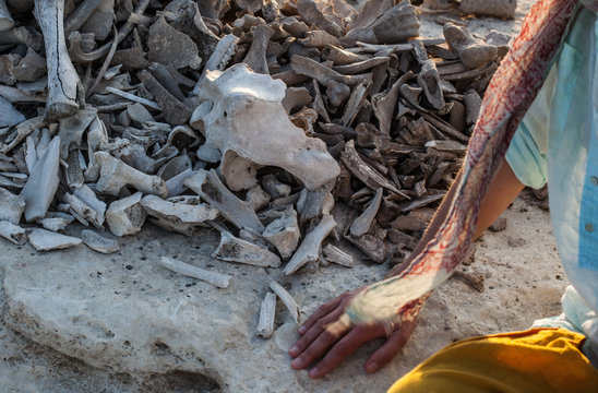 hand with bones
