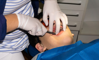 Obraz premium boy in dental treatment. brace. health care