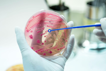 Close up the media plate on hand medical technicians working on bacterial culture and drug...