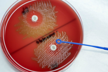 Optochin subsensitivity test on blood agar plate contains small light grains for Streptococcus pneumoniae; Focus on all agar surface.