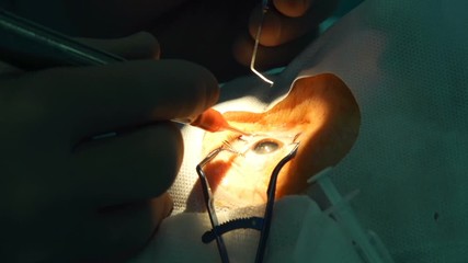 anesthesia before laser surgery vision correction, ophthalmology operation, Surgeon's hands in gloves performing laser eye vision correction correction, surgery eye, Cataract surgery