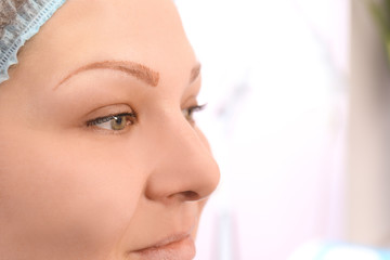 Obraz na płótnie Canvas Woman in process of eyebrow tattoo removal