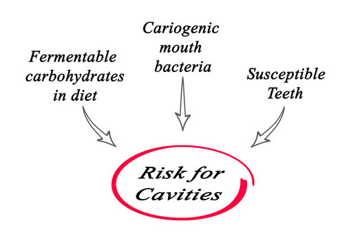 Risk for Cavities