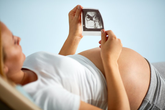 Unrecognizable pregnant woman lying on medical bench in doctors office and looking at black and white image of her baby from ultrasound scan