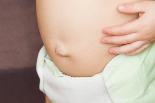 Bauch eines kleinen Kindes mit Nabelbruch