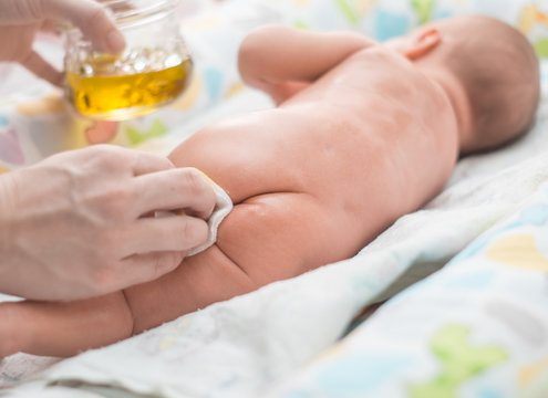 the mother treats the baby's skin