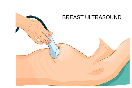 breast ultrasound. diagnosis of cancer