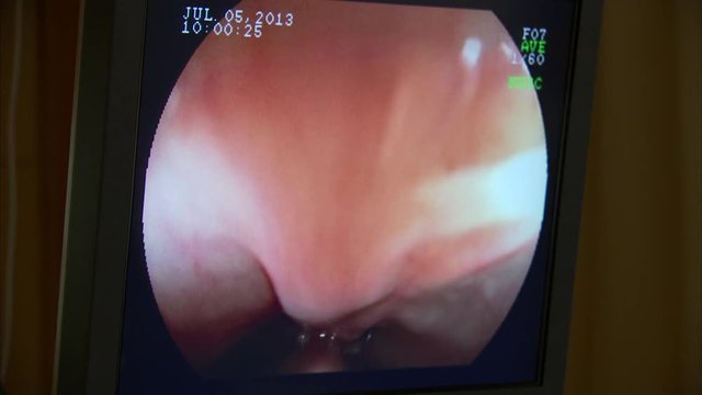 Endoscopy diagnose monitor