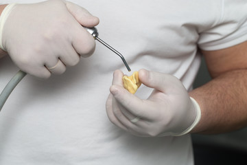 doctor makes a plastic prosthetic dentistry