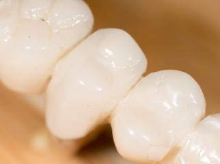 tooth torn. macro