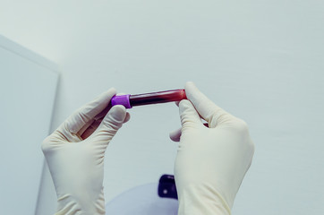 biochemical lab picked up a tube of blood tests to check. dopping, cholesterol, HIV