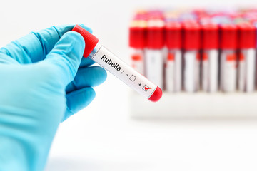 Obraz premium Blood sample positive with rubella virus