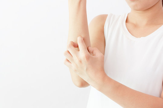 Women scratch the itch with hand / arm  itching / Concept with Healthcare And Medicine.