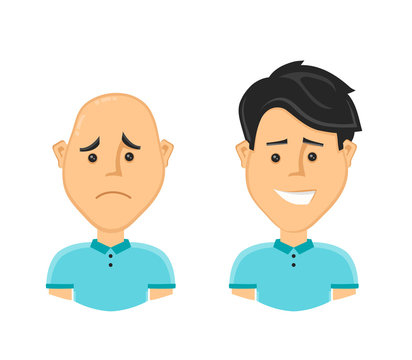 sad bald man and a happy man with a beautiful luxuriant long hair. Vector design flat cartoon character illustration. Isolated on white background. baldness concept