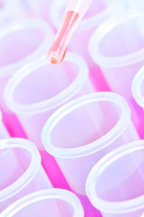 Red laboratory chemical test tubes and pipette with drop