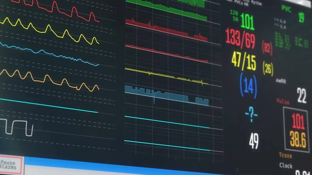 ICU bedside monitor showing person's vital signs, high temperature, illness. Medical ICU monitor with patient's vital signs
