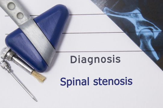 Neurological diagnosis of Spinal Stenosis. Neurologist directory, where is printed diagnosis Spinal Stenosis, lies on workplace with MRI image and neurological diagnostic tools close up