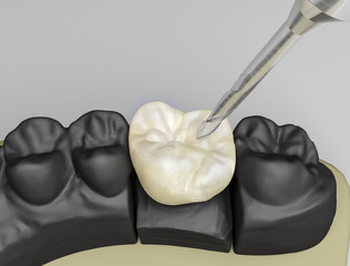 keramikkrone 3d © MStock