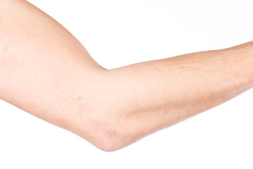 rechter Ellenbogen eines Mannes