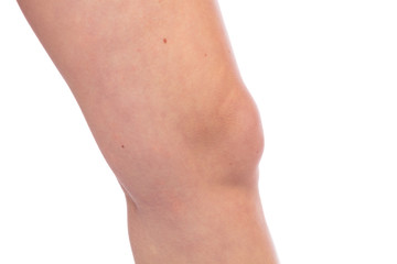 Fototapeta na wymiar Knie einer Frau