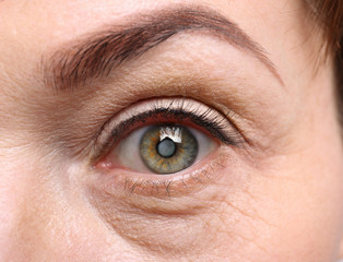Cataract concept. Senior woman's eye, closeup - obrazy, fototapety, plakaty