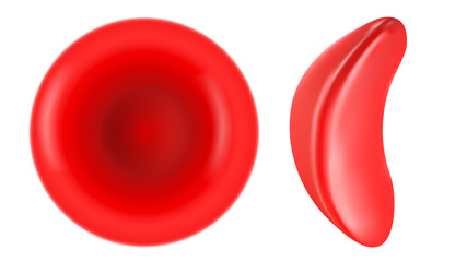 Sickle cell and normal red blood cell illustration