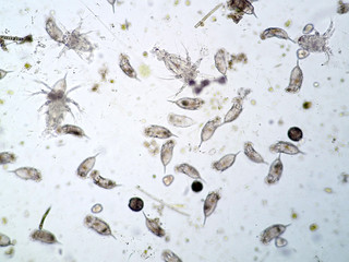 Freshwater aquatic plankton under microscope view
