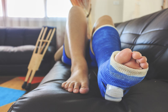 broken leg in a plaster cast with soft-focus in the background. over light
