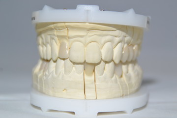 Fototapeta na wymiar modele dentaire 