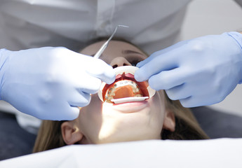 Naklejka premium Beautiful girl with braces on the teeth, at a reception at the dentist