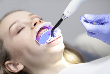 Dental cure. Molar treatment. Young female patient visiting dentist office. 