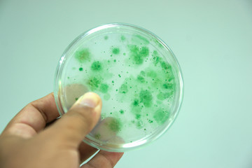 Colony of blue green algae in culture medium plate