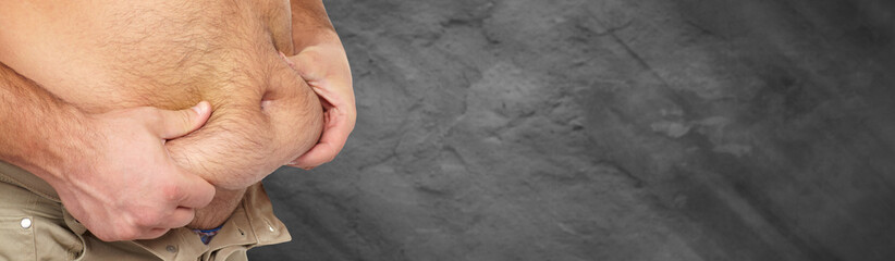 Fototapeta premium Obesity.