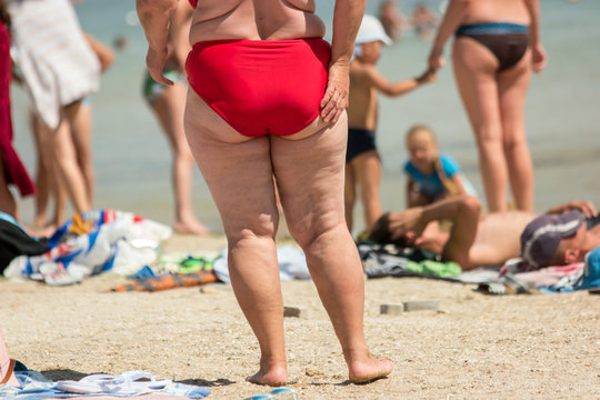 Legs of overweight lady. Fat woman on the beach. Aftermath of poor diet. Serious problems with metabolism.