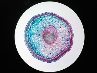 Cross sections of  plant root under microscope view
