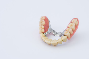 Dental prosthesis