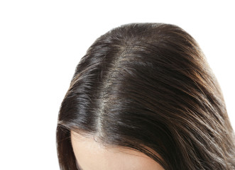 Young woman with hair loss problem on white background, closeup