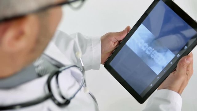 doctor checking xrays on tablet top view
