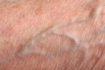 Fototapeta premium Detail of texture skin senior woman
